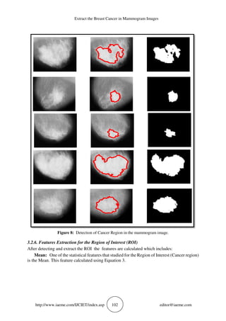 Extract the Breast Cancer in Mammogram Images
http://www.iaeme.com/IJCIET/index.asp 102 editor@iaeme.com
Figure 8: Detection of Cancer Region in the mammogram image.
3.2.6. Features Extraction for the Region of Interest (ROI)
After detecting and extract the ROI the features are calculated which includes:
Mean: One of the statistical features that studied for the Region of Interest (Cancer region)
is the Mean. This feature calculated using Equation 3.
 