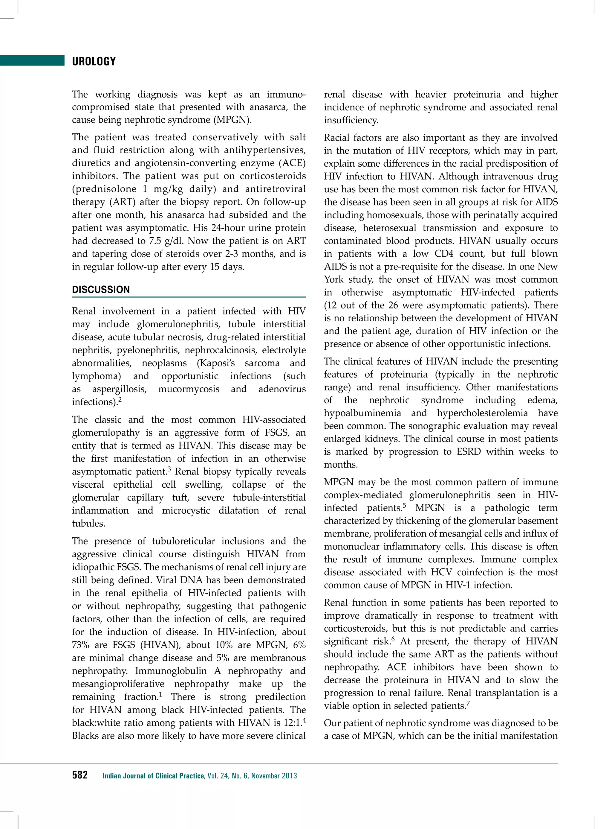 UROLOGY
The working diagnosis was kept as an immunocompromised state that presented with anasarca, the
cause being nephrotic syndrome (MPGN).

renal disease with heavier proteinuria and higher
incidence of nephrotic syndrome and associated renal
insufficiency.

The patient was treated conservatively with salt
and fluid restriction along with antihypertensives,
diuretics and angiotensin-converting enzyme (ACE)
inhibitors. The patient was put on corticosteroids
(prednisolone 1 mg/kg daily) and antiretroviral
therapy (ART) after the biopsy report. On follow-up
after one month, his anasarca had subsided and the
patient was asymptomatic. His 24-hour urine protein
had decreased to 7.5 g/dl. Now the patient is on ART
and tapering dose of steroids over 2-3 months, and is
in regular follow-up after every 15 days.

Racial factors are also important as they are involved
in the mutation of HIV receptors, which may in part,
explain some differences in the racial predisposition of
HIV infection to HIVAN. Although intravenous drug
use has been the most common risk factor for HIVAN,
the disease has been seen in all groups at risk for AIDS
including homosexuals, those with perinatally acquired
disease, heterosexual transmission and exposure to
contaminated blood products. HIVAN usually occurs
in patients with a low CD4 count, but full blown
AIDS is not a pre-requisite for the disease. In one New
York study, the onset of HIVAN was most common
in otherwise asymptomatic HIV-infected patients
(12 out of the 26 were asymptomatic patients). There
is no relationship between the development of HIVAN
and the patient age, duration of HIV infection or the
presence or absence of other opportunistic infections.

DISCUSSION
Renal involvement in a patient infected with HIV
may include glomerulonephritis, tubule interstitial
disease, acute tubular necrosis, drug-related interstitial
nephritis, pyelonephritis, nephrocalcinosis, electrolyte
abnormalities, neoplasms (Kaposi’s sarcoma and
lymphoma) and opportunistic infections (such
as aspergillosis, mucormycosis and adenovirus
infections).2
The classic and the most common HIV-associated
glomerulopathy is an aggressive form of FSGS, an
entity that is termed as HIVAN. This disease may be
the first manifestation of infection in an otherwise
asymptomatic patient.3 Renal biopsy typically reveals
visceral epithelial cell swelling, collapse of the
glomerular capillary tuft, severe tubule-interstitial
inflammation and microcystic dilatation of renal
tubules.
The presence of tubuloreticular inclusions and the
aggressive clinical course distinguish HIVAN from
idiopathic FSGS. The mechanisms of renal cell injury are
still being defined. Viral DNA has been demonstrated
in the renal epithelia of HIV-infected patients with
or without nephropathy, suggesting that pathogenic
factors, other than the infection of cells, are required
for the induction of disease. In HIV-infection, about
73% are FSGS (HIVAN), about 10% are MPGN, 6%
are minimal change disease and 5% are membranous
nephropathy. Immunoglobulin A nephropathy and
mesangioproliferative nephropathy make up the
remaining fraction.1 There is strong predilection
for HIVAN among black HIV-infected patients. The
black:white ratio among patients with HIVAN is 12:1.4
Blacks are also more likely to have more severe clinical

582

Indian Journal of Clinical Practice, Vol. 24, No. 6, November 2013

The clinical features of HIVAN include the presenting
features of proteinuria (typically in the nephrotic
range) and renal insufficiency. Other manifestations
of the nephrotic syndrome including edema,
hypoalbuminemia and hypercholesterolemia have
been common. The sonographic evaluation may reveal
enlarged kidneys. The clinical course in most patients
is marked by progression to ESRD within weeks to
months.
MPGN may be the most common pattern of immune
complex-mediated glomerulonephritis seen in HIVinfected patients.5 MPGN is a pathologic term
characterized by thickening of the glomerular basement
membrane, proliferation of mesangial cells and influx of
mononuclear inflammatory cells. This disease is often
the result of immune complexes. Immune complex
disease associated with HCV coinfection is the most
common cause of MPGN in HIV-1 infection.
Renal function in some patients has been reported to
improve dramatically in response to treatment with
corticosteroids, but this is not predictable and carries
significant risk.6 At present, the therapy of HIVAN
should include the same ART as the patients without
nephropathy. ACE inhibitors have been shown to
decrease the proteinura in HIVAN and to slow the
progression to renal failure. Renal transplantation is a
viable option in selected patients.7
Our patient of nephrotic syndrome was diagnosed to be
a case of MPGN, which can be the initial manifestation

 