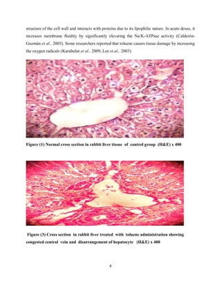 4
structure of the cell wall and interacts with proteins due to its lipophilic nature. In acute doses, it
increases membrane fluidity by significantly elevating the Na/K-ATPase activity (Calderón-
Guzmán et al., 2005). Some researchers reported that toluene causes tissue damage by increasing
the oxygen radicals (Karabulut et al., 2009; Lee et al., 2003).
Figure (1) Normal cross section in rabbit liver tissue of control group (H&E) x 400
Figure (3) Cross section in rabbit liver treated with toluene administration showing
congested central vein and disarrangement of hepatocyte (H&E) x 400
 