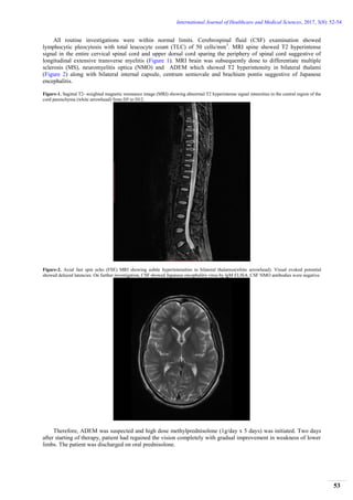 A Rare Case of ADEM after Japanese Encephalitis | PDF