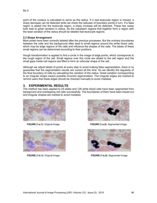 Biji G
International Journal of Image Processing (IJIP), Volume (12) : Issue (3) : 2018 86
point of the nucleus is calculated to serve as the radius. If a real leukocyte region is missed, a
sharp decrease can be detected while we check the radiuses of boundary points in turn. If a false
region is added into the leukocyte region, a sharp increase will be detected. These two cases
both lead to great variation in radius. So the cytoplasm regions that together form a region with
the least variation of the radius should be labeled real leukocyte regions.
2.3 Shape Arrangement
Most pixels have been correctly labeled after the previous processes. But the unsharp boundaries
between the cells and the background often lead to small regions around the white blood cells,
which may be edge regions of the cells and influence the shapes of the cells. The labels of these
small regions can be determined according to their positions.
Hough transformation is applied to find a circle in the image of edge points, which corresponds to
the rough region of the cell. Small regions over this circle are added to the cell region and the
small gaps inside cell regions are filled to form an orbicular shape of the cell.
Although we adjust labels of points at every step to avoid making false segmentation, there is no
guarantee that the segmentation results are correct all the time. So we identify the regularity of
the final boundary of cells by calculating the variation of the radius. Great variation corresponding
to an irregular shape means possible incorrect segmentation. The irregular edges are marked to
remind users that these edges should be checked manually to avoid mistakes
3. EXPERIMENTAL RESULTS
The method has been applied to 25 slides and 128 white blood cells have been segmented from
background and overlapping red cells successfully. The boundaries of them have been traced out
and irregular shapes are marked to avoid mistakes
FIGURE (1.a.1): Original Image. FIGURE (1.a.2): Segmented Image.
FIGURE (1.b.1): Original Image. FIGURE (1.b.2): Segmented Image.
 
