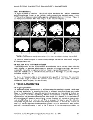 Fully Automatic Method for 3D T1-Weighted Brain Magnetic Resonance ...