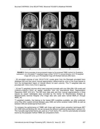 Bouchaib CHERRADI, Omar BOUATTANE, Mohamed YOUSSFI & Abdelhadi RAIHANI
International Journal of Image Processing (IJIP), Volume (5) : Issue (2) : 2011 227
a) b) c)
d) e) f)
g) h) k)
FIGURE 3: Some examples of pre-processed images by the proposed TMBE method (for Qualitative
evaluation). a)-c) Simulated T1-weighted image number 127/217 in coronal direction, d)-f) T2-weighted
image with tumor, g)-k) PD-weighted image with Multiple Sclerosis (MS) lesion.
- 20 simulated volumes of size 181x217x181 voxels given from the Brainweb simulated brain
database [40] and their given manual segmentation (determined by union of the three tissues to
form the correspondent region of interest (Brain) for each volume). This T1-weighted data are
provided with 1mm×1mm×1mm in spacing.
- 18 real T1-weighted volumes which were acquired coronally with size 256×256×128 voxels and
0.94mm×0.94mm×1.5mm as spatial resolution from the International Brain Segmentation
Repository IBSR V2.0 [41]. The MR brain data sets and their manual segmentations in three
tissues by expert radiologists were provided by the Center for Morphometric Analysis at
Massachusetts General Hospital (The image data sets used were named IBSR_01 through
IBSR_18).
T1-weighted modality, that belong to the fastest MRI modalities available, are often preferred,
since they offer a good contrast between gray (GM) and white cerebral matter (WM) as well as
between GM and cerebrospinal fluid (CSF).
To compare the performance of TMBE with three well known brain extraction techniques BET
[21], BSE [22] and McStrip [23, 24] we compute the different coefficients described in section 3.3.
The manually segmented brains are used as a Truth Verity (TV), and the automatically extracted
brains by the proposed method TBME are compared to them.
 