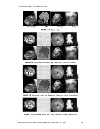 Analysis of Efficient Wavelet Based Volumetric Image Compression | PDF