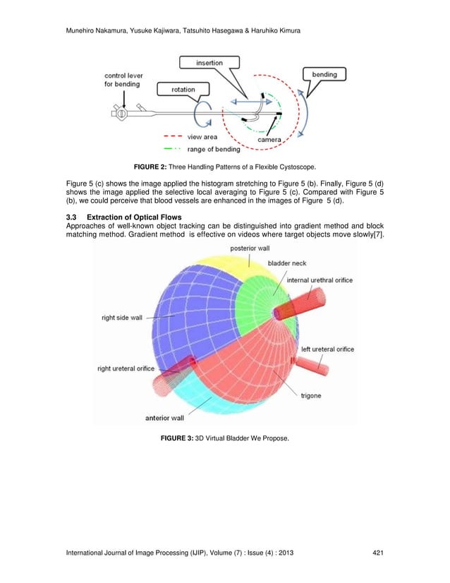 3D Position Tracking System for Flexible Cystoscopy | PDF