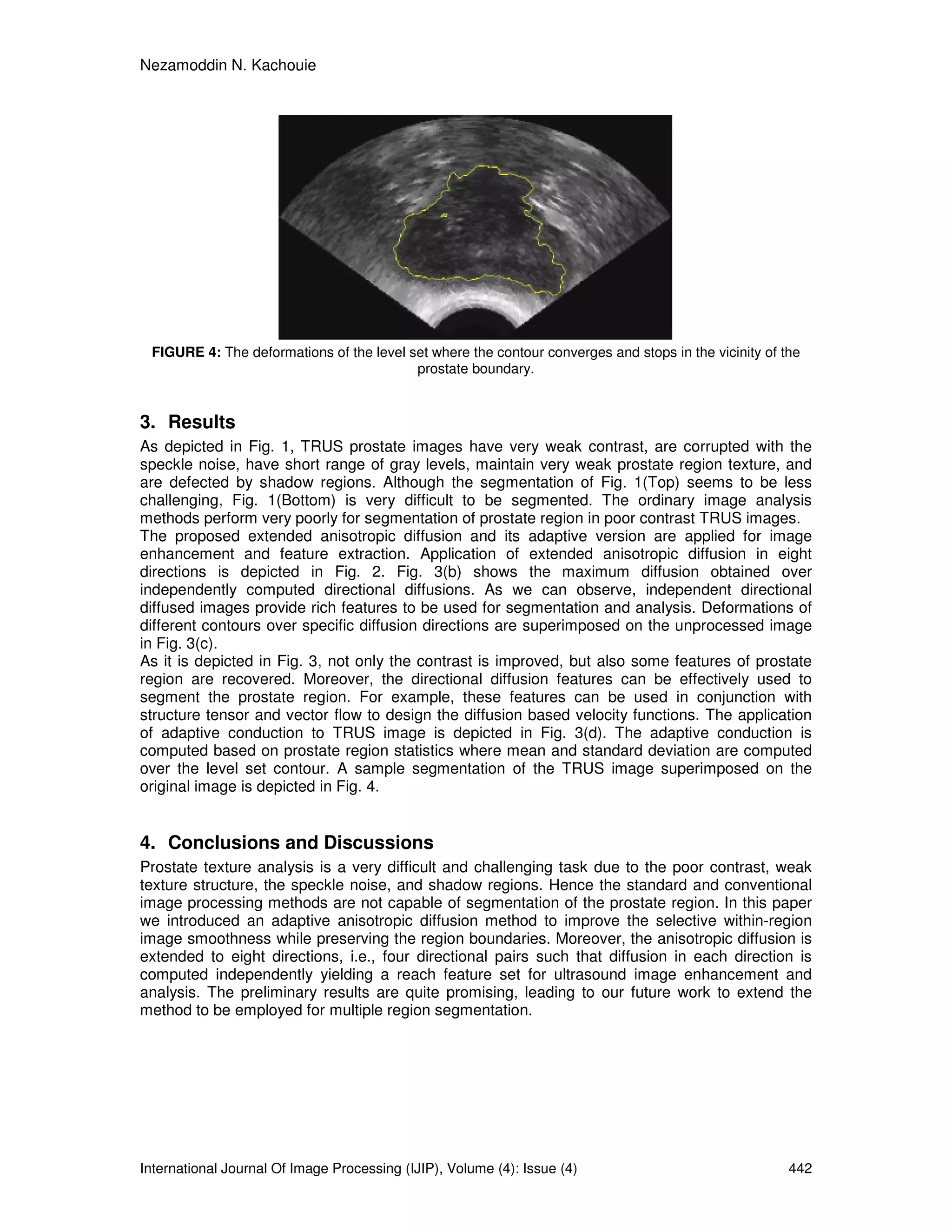 Nezamoddin N. Kachouie
International Journal Of Image Processing (IJIP), Volume (4): Issue (4) 442
FIGURE 4: The deformations of the level set where the contour converges and stops in the vicinity of the
prostate boundary.
3. Results
As depicted in Fig. 1, TRUS prostate images have very weak contrast, are corrupted with the
speckle noise, have short range of gray levels, maintain very weak prostate region texture, and
are defected by shadow regions. Although the segmentation of Fig. 1(Top) seems to be less
challenging, Fig. 1(Bottom) is very difficult to be segmented. The ordinary image analysis
methods perform very poorly for segmentation of prostate region in poor contrast TRUS images.
The proposed extended anisotropic diffusion and its adaptive version are applied for image
enhancement and feature extraction. Application of extended anisotropic diffusion in eight
directions is depicted in Fig. 2. Fig. 3(b) shows the maximum diffusion obtained over
independently computed directional diffusions. As we can observe, independent directional
diffused images provide rich features to be used for segmentation and analysis. Deformations of
different contours over specific diffusion directions are superimposed on the unprocessed image
in Fig. 3(c).
As it is depicted in Fig. 3, not only the contrast is improved, but also some features of prostate
region are recovered. Moreover, the directional diffusion features can be effectively used to
segment the prostate region. For example, these features can be used in conjunction with
structure tensor and vector flow to design the diffusion based velocity functions. The application
of adaptive conduction to TRUS image is depicted in Fig. 3(d). The adaptive conduction is
computed based on prostate region statistics where mean and standard deviation are computed
over the level set contour. A sample segmentation of the TRUS image superimposed on the
original image is depicted in Fig. 4.
4. Conclusions and Discussions
Prostate texture analysis is a very difficult and challenging task due to the poor contrast, weak
texture structure, the speckle noise, and shadow regions. Hence the standard and conventional
image processing methods are not capable of segmentation of the prostate region. In this paper
we introduced an adaptive anisotropic diffusion method to improve the selective within-region
image smoothness while preserving the region boundaries. Moreover, the anisotropic diffusion is
extended to eight directions, i.e., four directional pairs such that diffusion in each direction is
computed independently yielding a reach feature set for ultrasound image enhancement and
analysis. The preliminary results are quite promising, leading to our future work to extend the
method to be employed for multiple region segmentation.
 