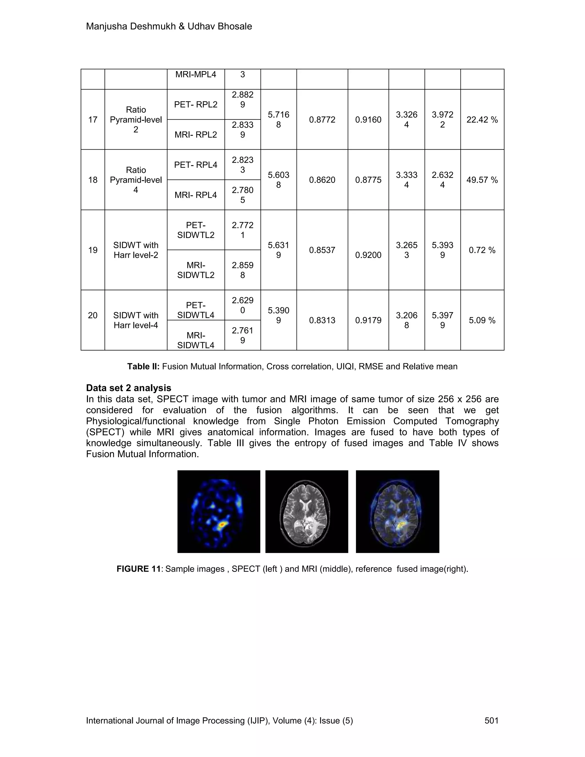 Manjusha Deshmukh & Udhav Bhosale
International Journal of Image Processing (IJIP), Volume (4): Issue (5) 501
MRI-MPL4 3
17
Ratio
Pyramid-level
2
PET- RPL2
2.882
9
5.716
8
0.8772 0.9160
3.326
4
3.972
2
22.42 %
MRI- RPL2
2.833
9
18
Ratio
Pyramid-level
4
PET- RPL4
2.823
3
5.603
8
0.8620 0.8775
3.333
4
2.632
4
49.57 %
MRI- RPL4
2.780
5
19
SIDWT with
Harr level-2
PET-
SIDWTL2
2.772
1
5.631
9
0.8537
0.9200
3.265
3
5.393
9
0.72 %
MRI-
SIDWTL2
2.859
8
20 SIDWT with
Harr level-4
PET-
SIDWTL4
2.629
0 5.390
9 0.8313 0.9179
3.206
8
5.397
9
5.09 %
MRI-
SIDWTL4
2.761
9
Table II: Fusion Mutual Information, Cross correlation, UIQI, RMSE and Relative mean
Data set 2 analysis
In this data set, SPECT image with tumor and MRI image of same tumor of size 256 x 256 are
considered for evaluation of the fusion algorithms. It can be seen that we get
Physiological/functional knowledge from Single Photon Emission Computed Tomography
(SPECT) while MRI gives anatomical information. Images are fused to have both types of
knowledge simultaneously. Table III gives the entropy of fused images and Table IV shows
Fusion Mutual Information.
FIGURE 11: Sample images , SPECT (left ) and MRI (middle), reference fused image(right).
 