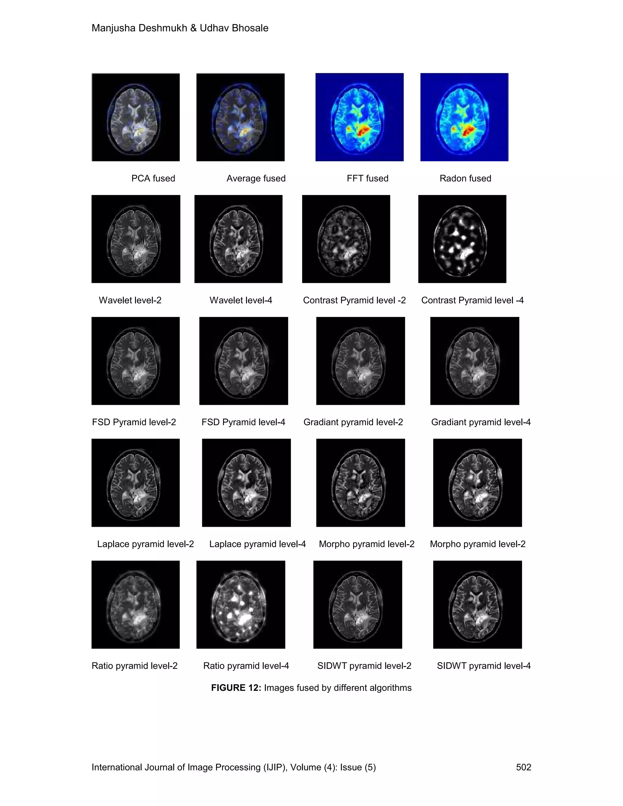 Manjusha Deshmukh & Udhav Bhosale
International Journal of Image Processing (IJIP), Volume (4): Issue (5) 502
PCA fused Average fused FFT fused Radon fused
Wavelet level-2 Wavelet level-4 Contrast Pyramid level -2 Contrast Pyramid level -4
FSD Pyramid level-2 FSD Pyramid level-4 Gradiant pyramid level-2 Gradiant pyramid level-4
Laplace pyramid level-2 Laplace pyramid level-4 Morpho pyramid level-2 Morpho pyramid level-2
Ratio pyramid level-2 Ratio pyramid level-4 SIDWT pyramid level-2 SIDWT pyramid level-4
FIGURE 12: Images fused by different algorithms
 