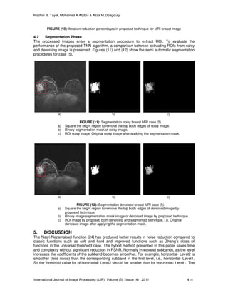 Mazhar B. Tayel, Mohamed A.Abdou & Azza M.Elbagoury
International Journal of Image Processing (IJIP), Volume (5) : Issue (4) : 2011 414
FIGURE (10): Iteration reduction percentages in proposed technique for MRI breast image
4.2 Segmentation Phase
The processed images enter a segmentation procedure to extract ROI. To evaluate the
performance of the proposed TNN algorithm, a comparison between extracting ROIs from noisy
and denoising image is presented. Figures (11) and (12) show the semi automatic segmentation
procedures for case (5).
a) b) c)
FIGURE (11): Segmentation noisy breast MRI case (5).
a) Square the bright region to remove the top body edges of noisy image.
b) Binary segmentation mask of noisy image.
c) ROI noisy image. Original noisy image after applying the segmentation mask.
a) b) c)
FIGURE (12): Segmentation denoised breast MRI case (5).
a) Square the bright region to remove the top body edges of denoised image by
proposed technique.
b) Binary image segmentation mask image of denoised image by proposed technique.
c) ROI image by proposed both denoising and segmented technique. i.e. Original
denoised image after applying the segmentation mask.
5. DISCUSSION
The Nasri-Nezamabadi function [24] has produced better results in noise reduction compared to
classic functions such as soft and hard and improved functions such as Zhang’s class of
functions in the universal threshold case. The hybrid method presented in this paper saves time
and complexity without significant reduction in PSNR. Normally in wavelet subbands, as the level
increases the coefficients of the subband becomes smoother. For example, horizontal- Level2 is
smoother (less noise) than the corresponding subband in the first level, i.e., horizontal- Level1.
So the threshold value for of horizontal- Level2 should be smaller than for horizontal- Level1. The
 