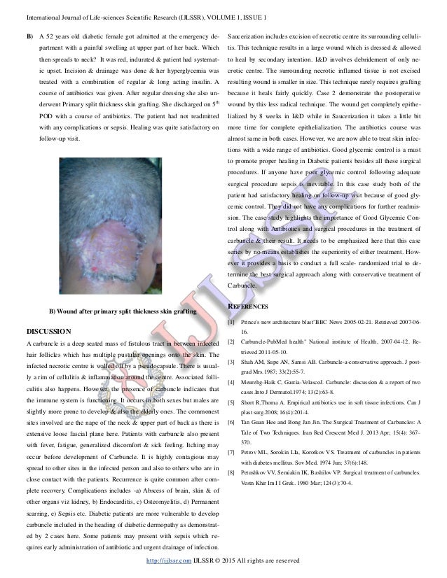 Carbuncle case study 07 picture
