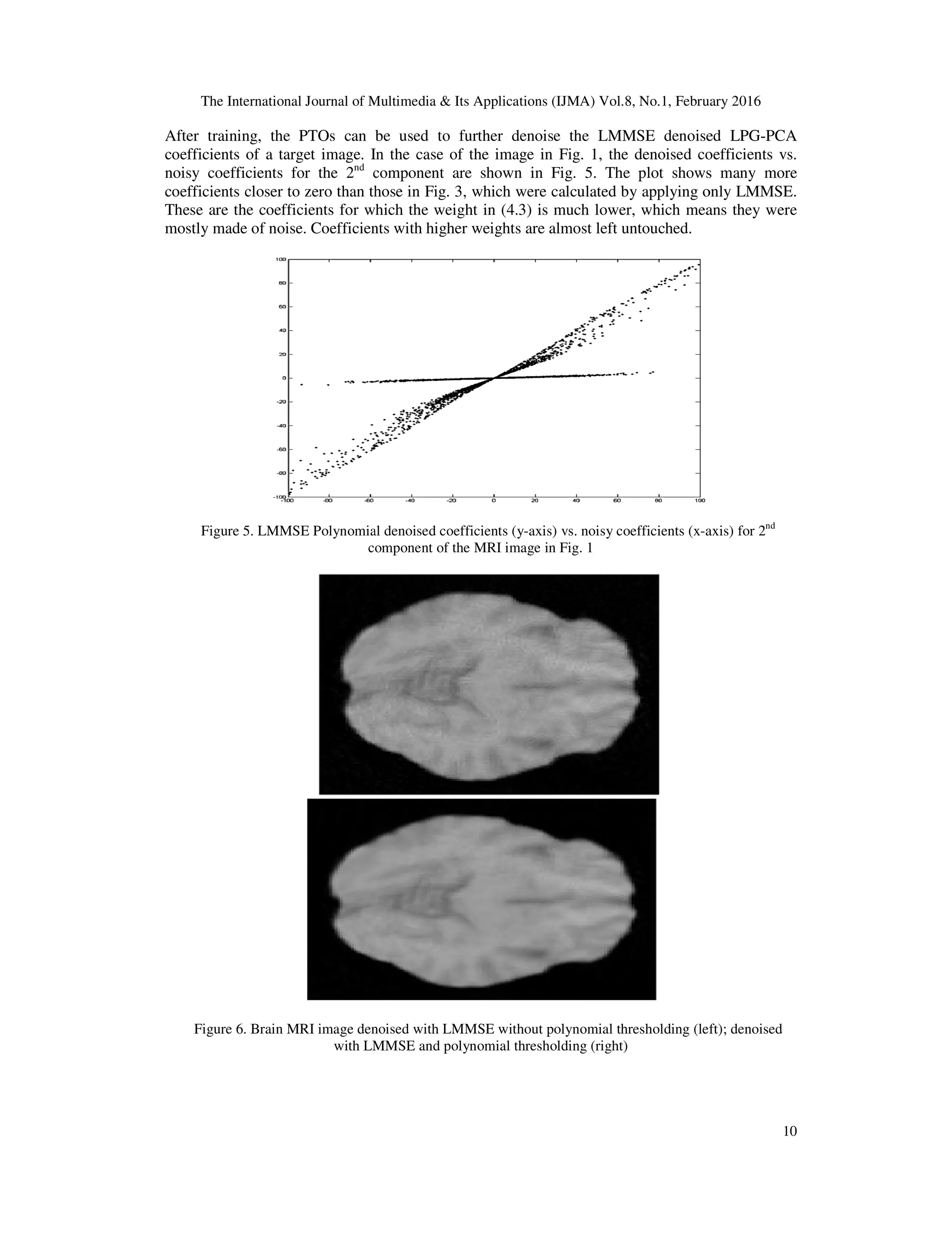 The International Journal of Multimedia & Its Applications (IJMA) Vol.8, No.1, February 2016 After training, the PTOs can be used to further denoise the LMMSE denoised LPG coefficients of a target image. In the case of the image in Fig. 1, the denoised coefficients vs. noisy coefficients for the 2nd component are shown in Fig. 5. The plot shows many more coefficients closer to zero than those in Fig. 3, which were calculated by applying only LMMSE. These are the coefficients for which the weight in (4.3) is much lower, which means they were mostly made of noise. Coefficients with higher weights are almost left untouched. Figure 5. LMMSE Polynomial denoised coefficients (y component of the MRI image in Fig. 1 Figure 6. Brain MRI image denoised with with LMMSE and polynomial thresholding (right) The International Journal of Multimedia & Its Applications (IJMA) Vol.8, No.1, February 2016 After training, the PTOs can be used to further denoise the LMMSE denoised LPG coefficients of a target image. In the case of the image in Fig. 1, the denoised coefficients vs. component are shown in Fig. 5. The plot shows many more coefficients closer to zero than those in Fig. 3, which were calculated by applying only LMMSE. These are the coefficients for which the weight in (4.3) is much lower, which means they were de of noise. Coefficients with higher weights are almost left untouched. . LMMSE Polynomial denoised coefficients (y-axis) vs. noisy coefficients (x-axis) for 2 component of the MRI image in Fig. 1 . Brain MRI image denoised with LMMSE without polynomial thresholding (left); denoised with LMMSE and polynomial thresholding (right) The International Journal of Multimedia & Its Applications (IJMA) Vol.8, No.1, February 2016 10 After training, the PTOs can be used to further denoise the LMMSE denoised LPG-PCA coefficients of a target image. In the case of the image in Fig. 1, the denoised coefficients vs. component are shown in Fig. 5. The plot shows many more coefficients closer to zero than those in Fig. 3, which were calculated by applying only LMMSE. These are the coefficients for which the weight in (4.3) is much lower, which means they were axis) for 2nd LMMSE without polynomial thresholding (left); denoised 