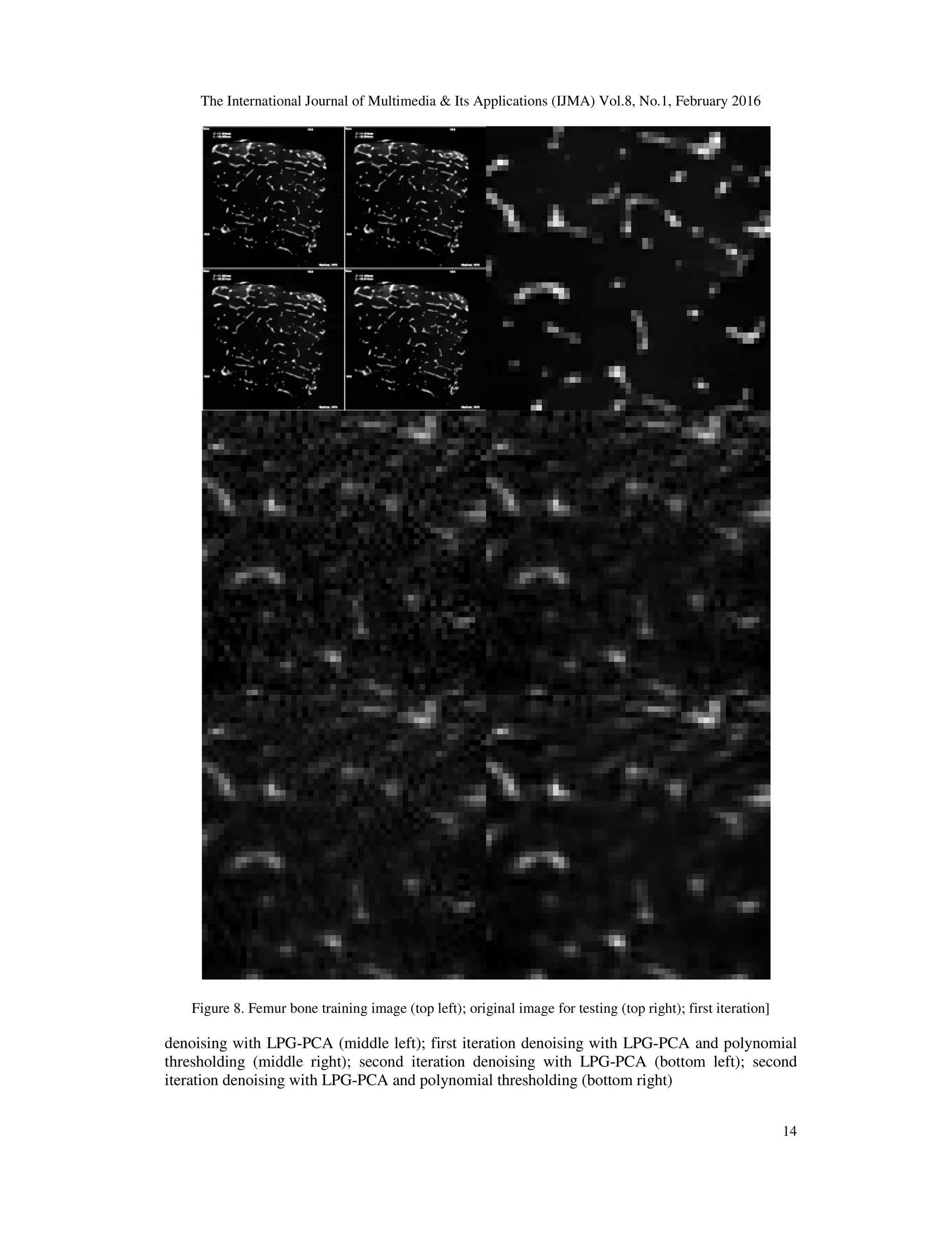The International Journal of Multimedia & Its Applications (IJMA) Vol.8, No.1, February 2016 14 Figure 8. Femur bone training image (top left); original image for testing (top right); first iteration] denoising with LPG-PCA (middle left); first iteration denoising with LPG-PCA and polynomial thresholding (middle right); second iteration denoising with LPG-PCA (bottom left); second iteration denoising with LPG-PCA and polynomial thresholding (bottom right) 