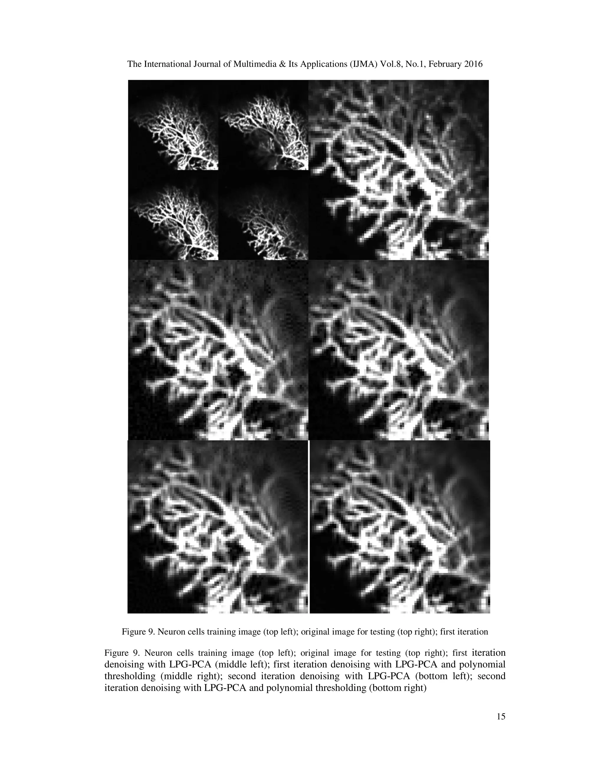 The International Journal of Multimedia & Its Applications (IJMA) Vol.8, No.1, February 2016 15 Figure 9. Neuron cells training image (top left); original image for testing (top right); first iteration Figure 9. Neuron cells training image (top left); original image for testing (top right); first iteration denoising with LPG-PCA (middle left); first iteration denoising with LPG-PCA and polynomial thresholding (middle right); second iteration denoising with LPG-PCA (bottom left); second iteration denoising with LPG-PCA and polynomial thresholding (bottom right) 