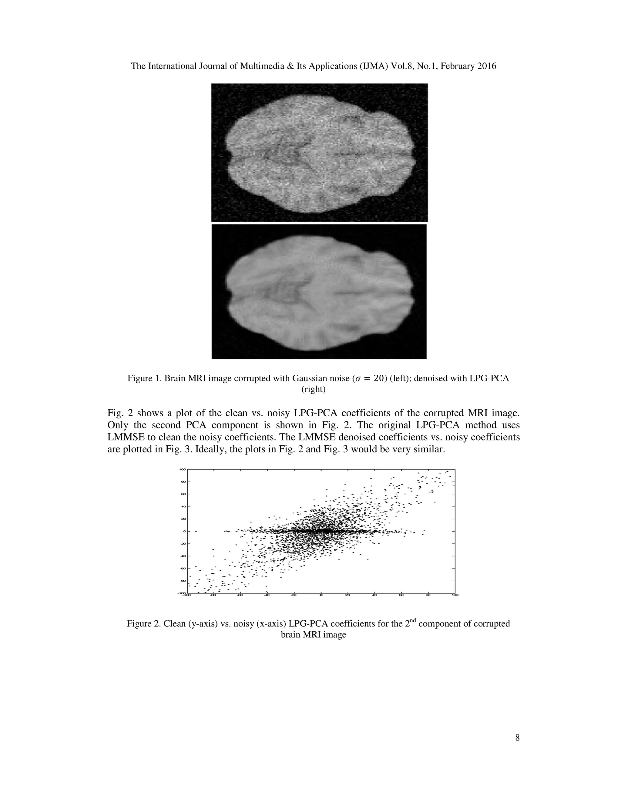 The International Journal of Multimedia & Its Applications (IJMA) Vol.8, No.1, February 2016 Figure 1. Brain MRI image corrupted with Gaussian noise ( Fig. 2 shows a plot of the clean vs. noisy LPG Only the second PCA component LMMSE to clean the noisy coefficients. The LMMSE denoised coefficients vs. noisy coefficients are plotted in Fig. 3. Ideally, the plots in Fig. 2 and Fig. 3 would be very similar. Figure 2. Clean (y-axis) vs. noisy (x The International Journal of Multimedia & Its Applications (IJMA) Vol.8, No.1, February 2016 Brain MRI image corrupted with Gaussian noise (ߪ = 20) (left); denoised with LPG (right) Fig. 2 shows a plot of the clean vs. noisy LPG-PCA coefficients of the corrupted MRI image. Only the second PCA component is shown in Fig. 2. The original LPG-PCA method uses LMMSE to clean the noisy coefficients. The LMMSE denoised coefficients vs. noisy coefficients are plotted in Fig. 3. Ideally, the plots in Fig. 2 and Fig. 3 would be very similar. axis) vs. noisy (x-axis) LPG-PCA coefficients for the 2nd component of corrupted brain MRI image The International Journal of Multimedia & Its Applications (IJMA) Vol.8, No.1, February 2016 8 ) (left); denoised with LPG-PCA PCA coefficients of the corrupted MRI image. PCA method uses LMMSE to clean the noisy coefficients. The LMMSE denoised coefficients vs. noisy coefficients component of corrupted 