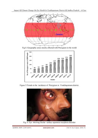 Impact Of Climate Change On Eye Health In Visakhapatnam District Of Andhra Pradesh – A Case
| IJMER | ISSN: 2249–6645 | www.ijmer.com | Vol. 4 | Iss. 6| June. 2014 | 5|
Fig.4. Geographic areas mostly affected with Pterygium in the world
Figure 5.Trends in the incidence of Pterygium in Visakhapatnam district.
Fig. 6. Eye showing Ocular surface squamous neoplasia disorder
 