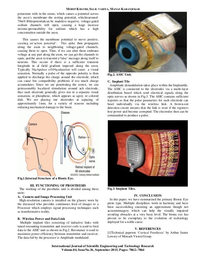 bionic ear research paper A visual prosthesis many devices have been developed, usually modeled on the cochlear implant or bionic ear devices, a type of neural prosthesis in use since the have supported the work at second sight, usc, ucsc, caltech, and other research labs microsystem-based visual. bionic ear research paper A visual prosthesis many devices have been developed, usually modeled on the cochlear implant or bionic ear devices, a type of neural prosthesis in use since the have supported the work at second sight, usc, ucsc, caltech, and other research labs microsystem-based visual.