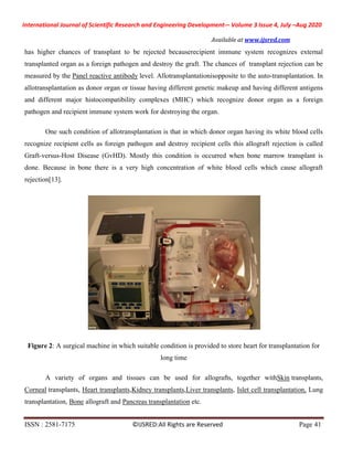 Organ Transplantation Methods and Major Reasons of Organ Rejection | PDF
