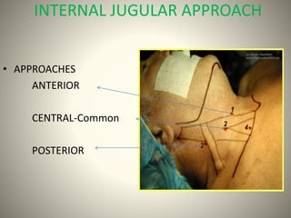anatomical review of internal jugular vein cannulation.pptx