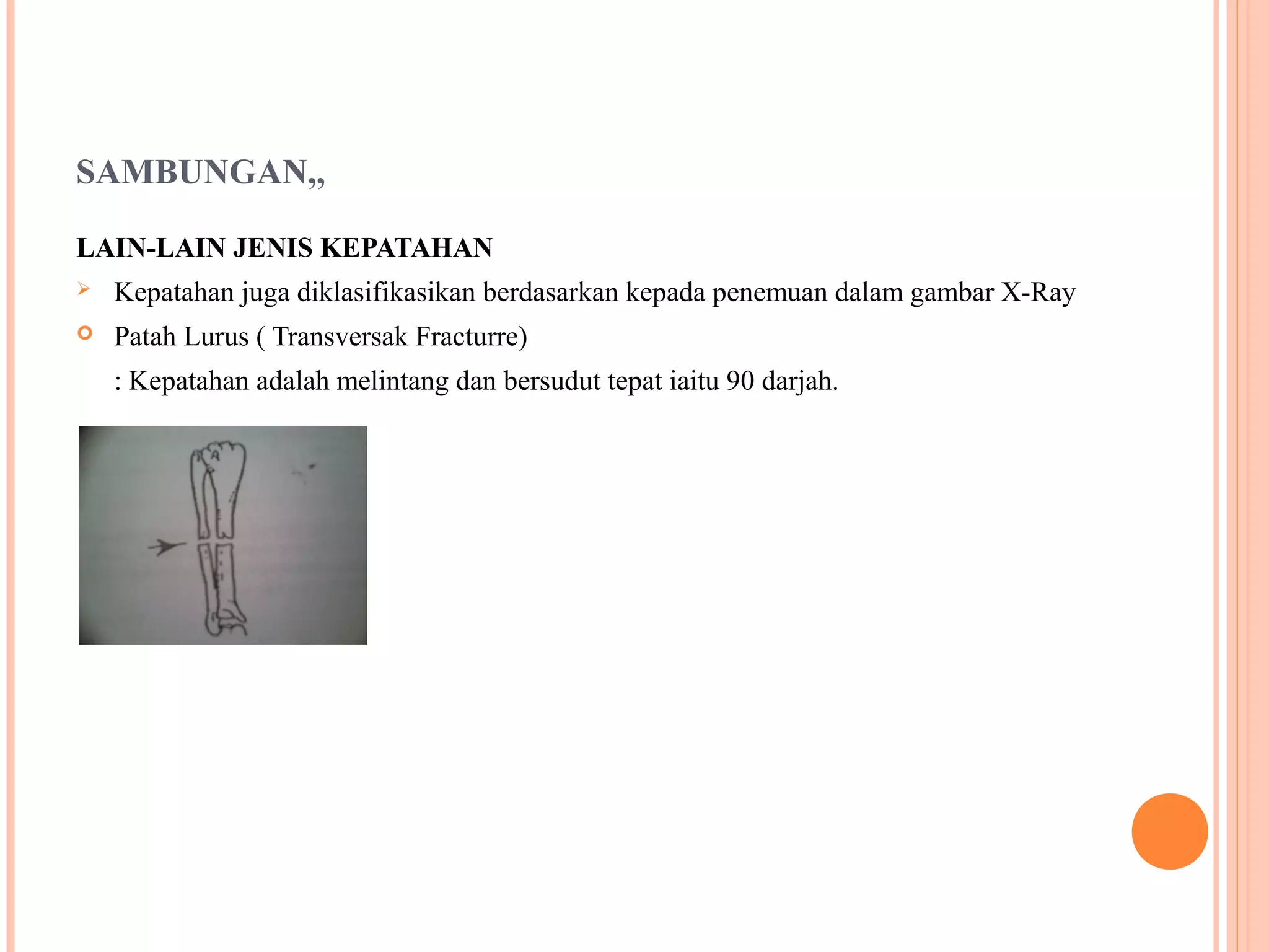 SAMBUNGAN,,
LAIN-LAIN JENIS KEPATAHAN
 Kepatahan juga diklasifikasikan berdasarkan kepada penemuan dalam gambar X-Ray
 Patah Lurus ( Transversak Fracturre)
: Kepatahan adalah melintang dan bersudut tepat iaitu 90 darjah.
 