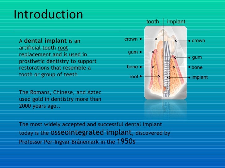 Comparative Study on Ti Surface Modified by Grit Blasting and Acid Et…