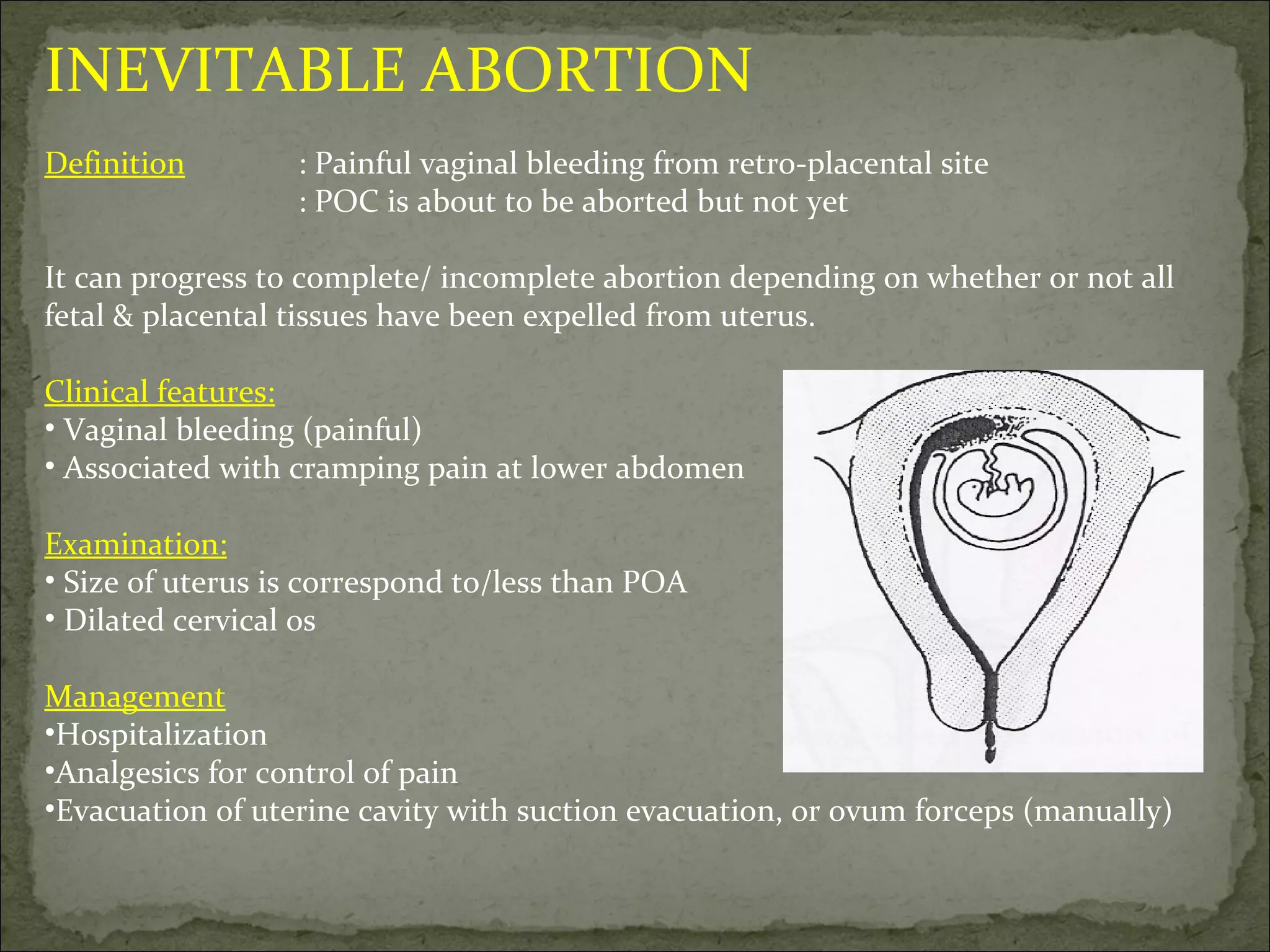 INEVITABLE ABORTION Definition : Painful vaginal bleeding from retro-placental site : POC is about to be aborted but not yet It can progress to complete/ incomplete abortion depending on whether or not all fetal & placental tissues have been expelled from uterus. Clinical features: Vaginal bleeding (painful) Associated with cramping pain at lower abdomen Examination: Size of uterus is correspond to/less than POA Dilated cervical os Management Hospitalization Analgesics for control of pain Evacuation of uterine cavity with suction evacuation, or ovum forceps (manually) 