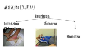 arriskuak(ZAURIAK)
Zauritzea
Infekzioa Sukarra
Eldarniatu
Heriotza
 