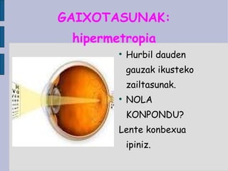 GAIXOTASUNAK: hipermetropia Hurbil dauden gauzak ikusteko zailtasunak. NOLA KONPONDU? Lente konbexua ipiniz. 