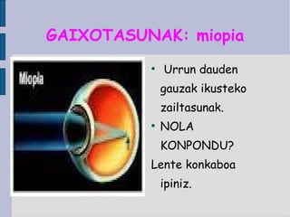 GAIXOTASUNAK: miopia Urrun dauden gauzak ikusteko zailtasunak. NOLA KONPONDU? Lente konkaboa ipiniz. 