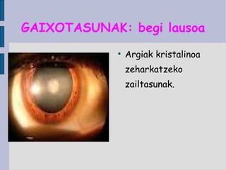 GAIXOTASUNAK: begi lausoa Argiak kristalinoa zeharkatzeko zailtasunak. 
