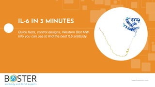 www.bosterbio.com
Quick facts, control designs, Western Blot MW.
Info you can use to find the best IL6 antibody.
IL-6 IN 3 MINUTES
 