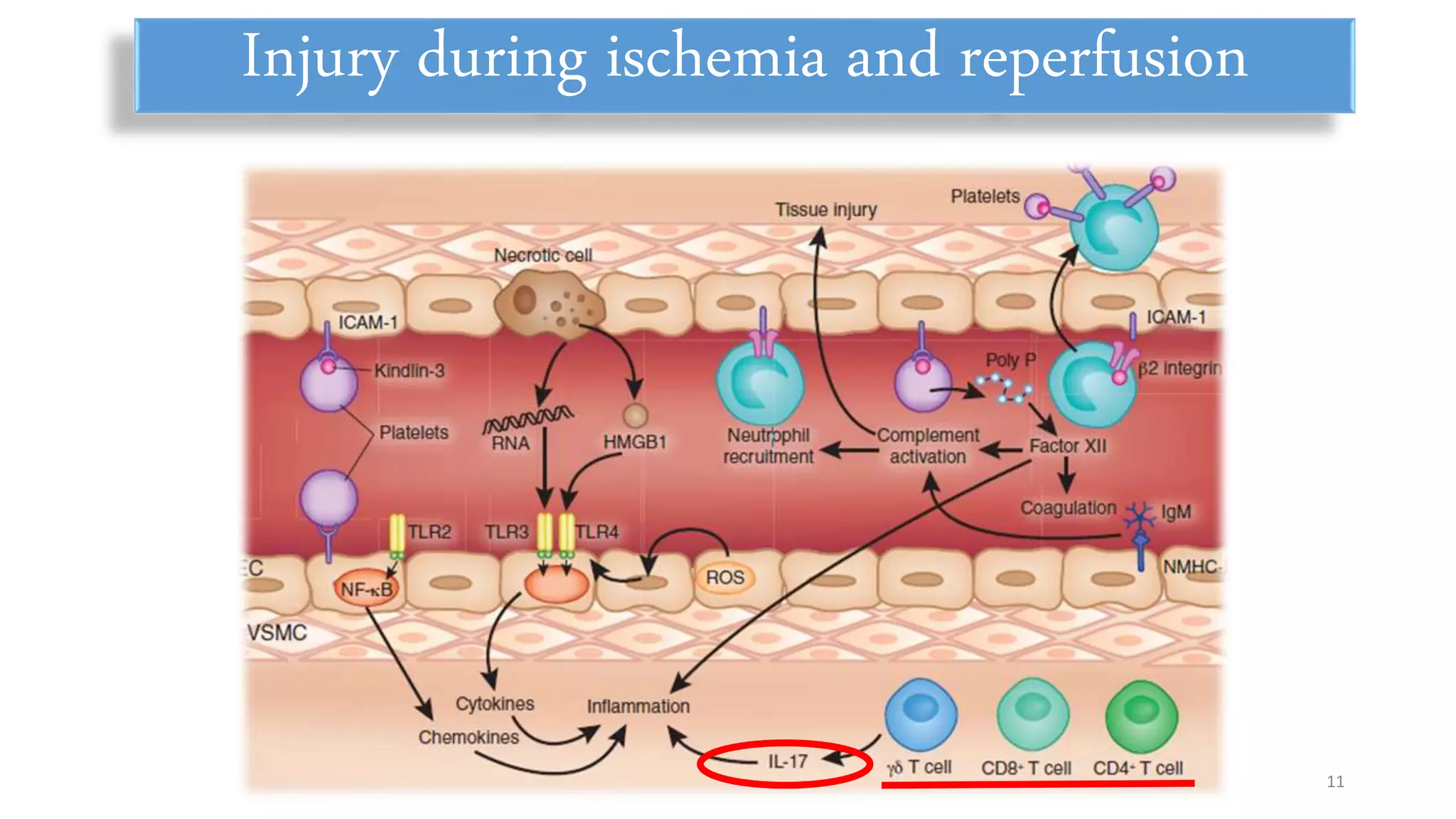 Injury during ischemia and reperfusion
11
 