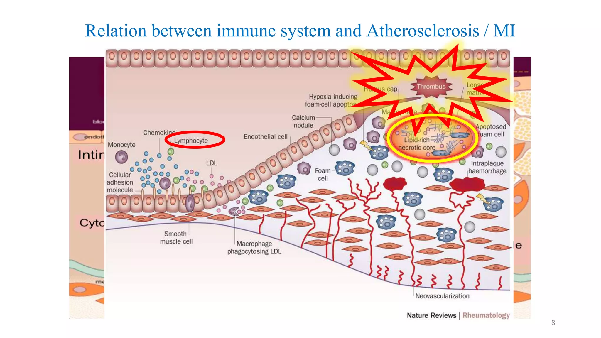 Relation between immune system and Atherosclerosis / MI
8
 