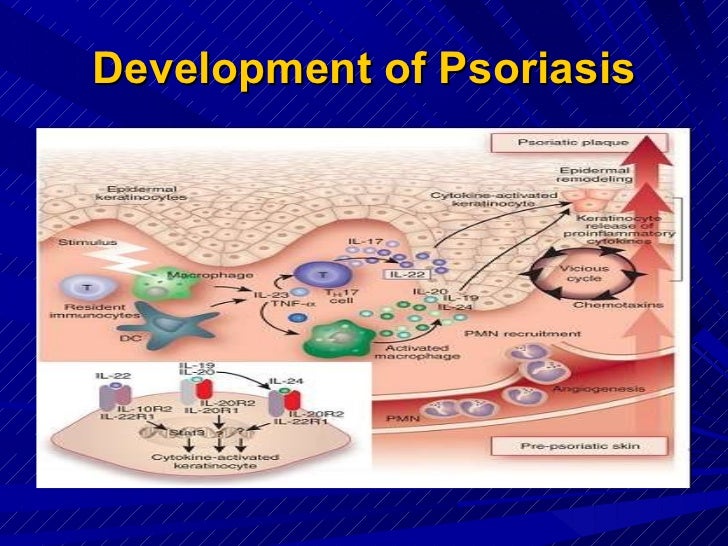 Il17 &stat 3 in psoriasis pathogenesis