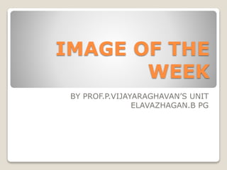 IMAGE OF THE
WEEK
BY PROF.P.VIJAYARAGHAVAN’S UNIT
ELAVAZHAGAN.B PG
 