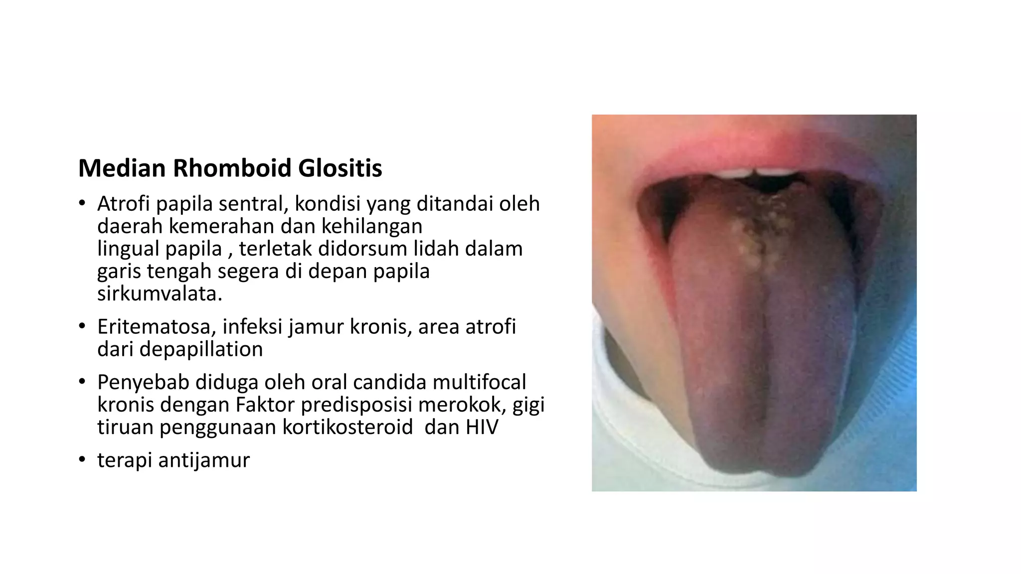 Anatomi & Fisiologi Lidah | PPTX