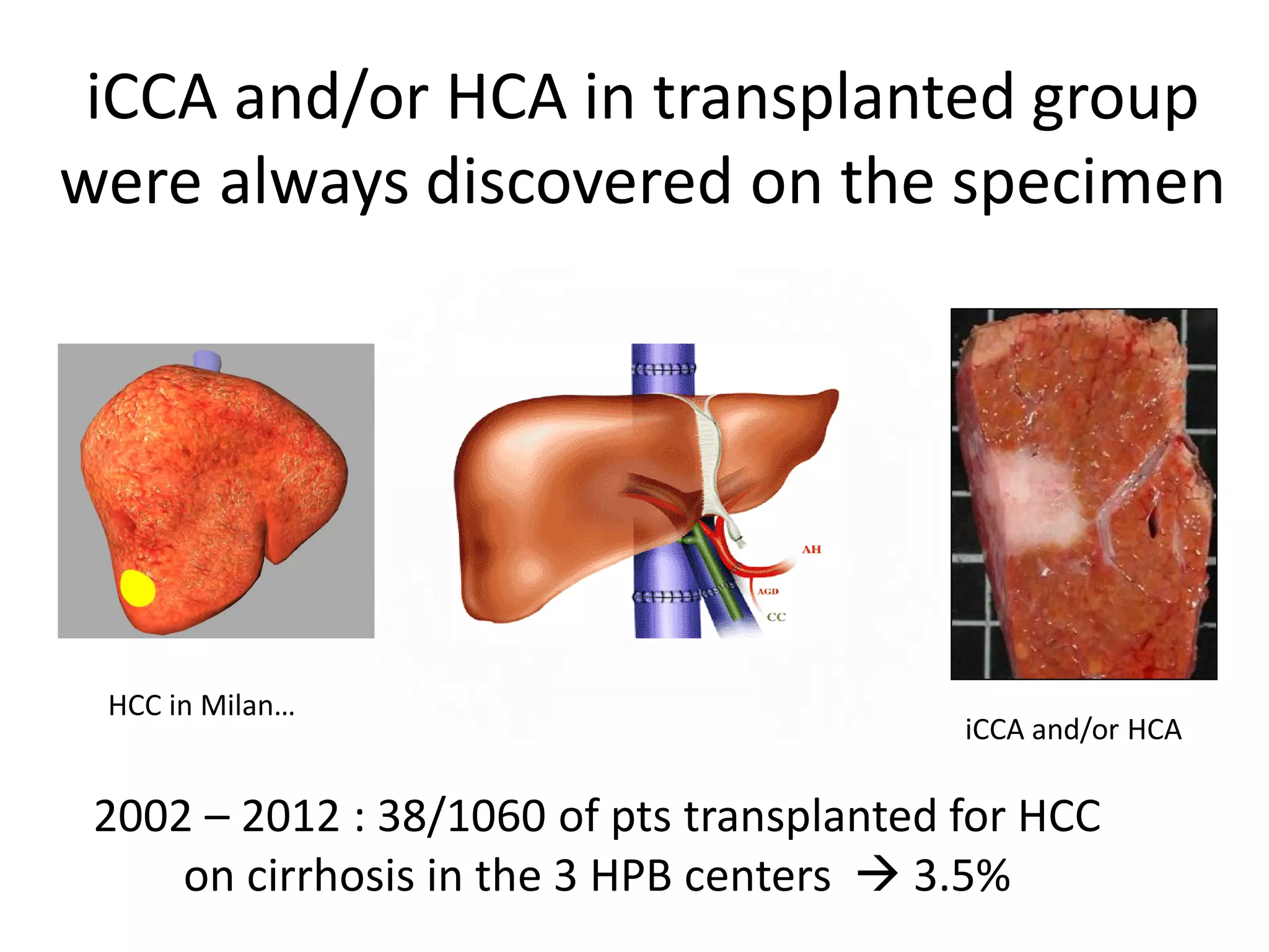 Liver transplantation vs Resection in cholangiocarcinoma on cirrhosis | PPT