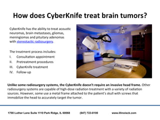 How	
  does	
  CyberKnife	
  treat	
  brain	
  tumors?	
  
 CyberKnife	
  has	
  the	
  ability	
  to	
  treat	
  acous;c	...