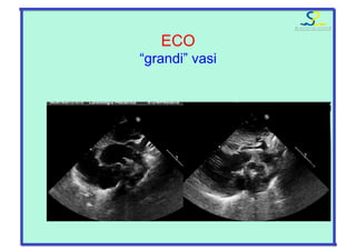 ECO
“grandi” vasi
 