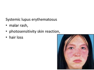 Systemic lupus erythematosus
• malar rash,
• photosensitivity skin reaction,
• hair loss
 
