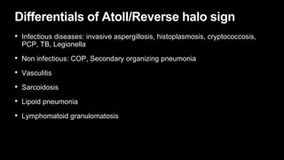 Differentials of Atoll/Reverse halo sign
• Infectious diseases: invasive aspergillosis, histoplasmosis, cryptococcosis,
PCP, TB, Legionella
• Non infectious: COP, Secondary organizing pneumonia
• Vasculitis
• Sarcoidosis
• Lipoid pneumonia
• Lymphomatoid granulomatosis
 