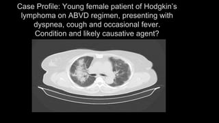 Case Profile: Young female patient of Hodgkin’s
lymphoma on ABVD regimen, presenting with
dyspnea, cough and occasional fever.
Condition and likely causative agent?
 