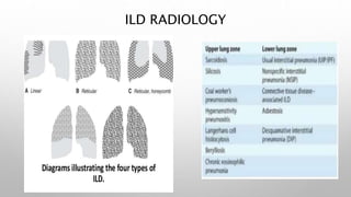 Ild Algorithm Radiology ILD clinical update.pptx