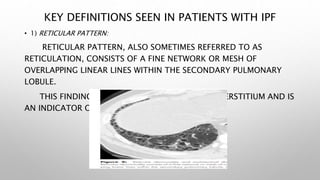 ILD clinical update.pptx