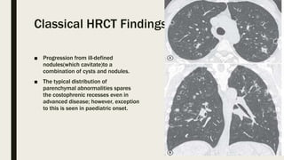 Interstitial lung disease and Occupational lung disease HRCT | PPTX