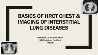 BASICS OF HRCT CHEST &
IMAGING OF INTERSTITIAL
LUNG DISEASES
Presenter: Dr. SHAROJ KHAN
MD Radiology Resident
NMCTH
 
