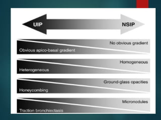 Interstitial lung disease radiology presentation | PPTX