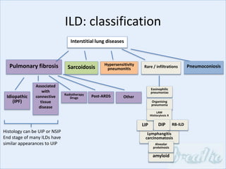 Interstitial lung diseases
Sarcoidosis
Idiopathic
(IPF)
Associated
with
connective
tissue
disease
Radiotherapy
Drugs Post-ARDS
Pulmonary fibrosis Hypersensitivity
pneumonitis Rare / infiltrations
Lymphangitis
carcinomatosis
LIP
Eosinophilic
pneumonias
Organising
pneumonia
LAM
Histiocytosis X
Pneumoconiosis
amyloid
Histology can be UIP or NSIP
End stage of many ILDs have
similar appearances to UIP Alveolar
proteinosis
ILD: classification
Other
RB-ILDDIP
 