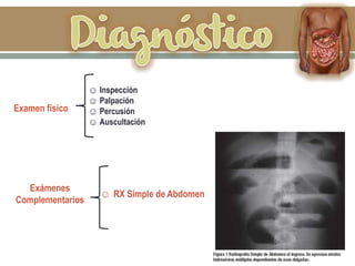 ☺ Inspección
☺ Palpación
☺ Percusión
☺ Auscultación
Examen físico
Exámenes
Complementarios
☺ RX Simple de Abdomen
 