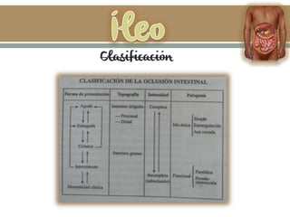 Clasificación
 