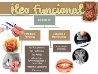 Se divide en:
Paralítico o
Adinámico
Íleo Posoperatorio
Íleo Peritonítico
Íleo Reflejo
Alteraciones
Toxicometabólicas y
carenciales
Trastornos vasculares
Fármacos
Espástico o
Hiperdinámico
Contractura
localizada
 
